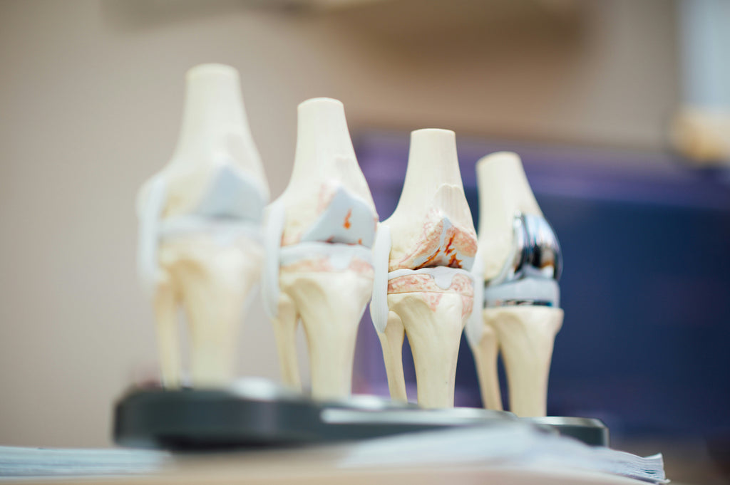 CBD gegen Arthritis / Gelenkschmerzen