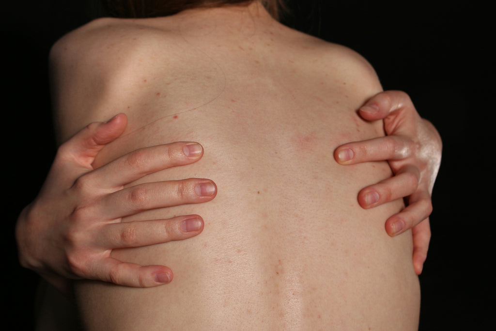 CBD bei Fibromyalgie